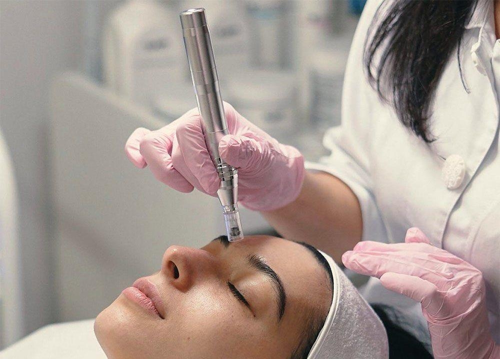 Scalp Image