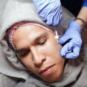 Rejuran S (Scar Repair)